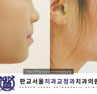 이미지가 없습니다.