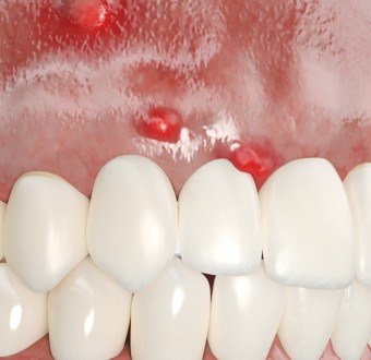 이미지가 없습니다.