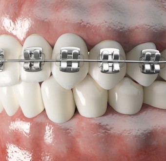 이미지가 없습니다.